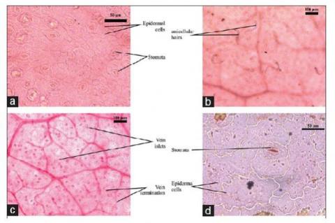 Foliar Epidermal Study on Selected Medicinal Plants Used in Homeopathy