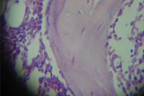 Photomicrography of left femur of OVX+Test2 group