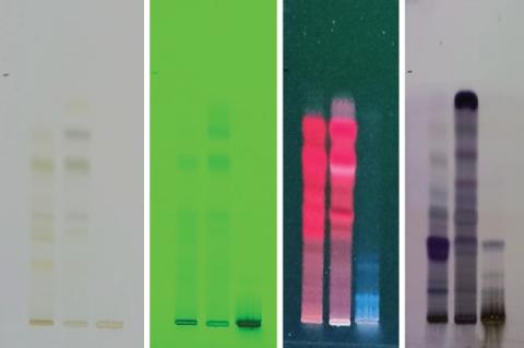 High Pressure Thin Layer Chromatography: A (Visible light), B (254 nm, UV light), C (366 nm, UV light) and D (366 nm, Post Derivetization, UV light)