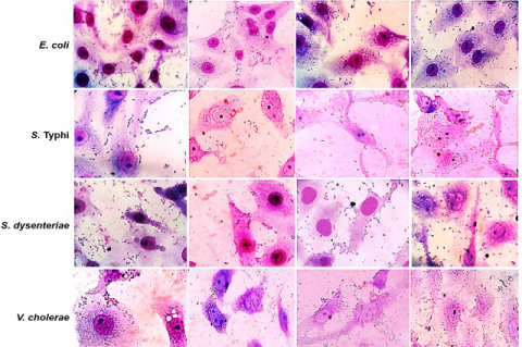 Giemsa staining of enteric pathogenic bacteria on Vero cells after being treated with the ethanolic extract of green tea combined with G. cowa, green tea extract and G. cowa extract, respectively, and comparing with the untreated control. Adhesion of bacteria on Vero cells observed under oil immersion microscope (100X) after staining with Giemsa stain.