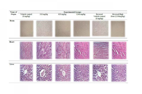 Histopathology of female organs.