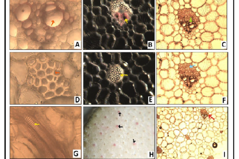 Transverse section of Sansevieria cylindrica leaves shows A: Metaxylem (X 400)