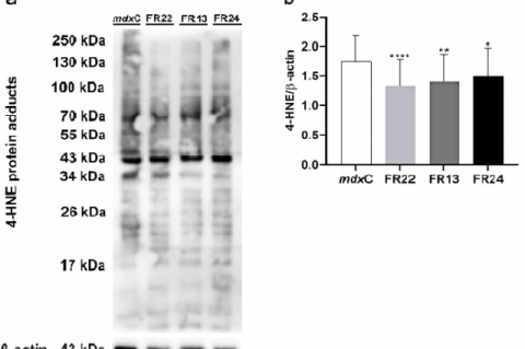Western blotting analysis of 4-HNE protein adducts (A) in muscle cells from mdxC (dystrophic untreated cells) and treated at different fractions