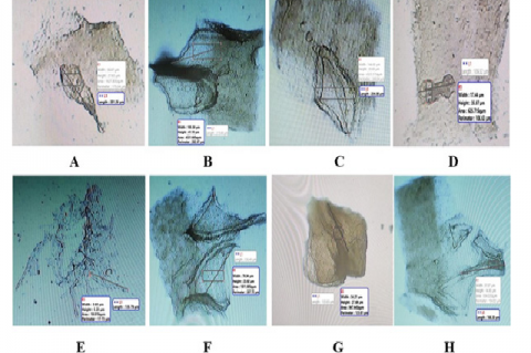 Quantitative microscopy of hymenium of fruiting body A. Clavate, 4-sterigmate basidium, B. Sphaeropedunculate, C. lanceolate thick-walled, D. utriform, E. Aciculate, F. Mucronate, G. Cornuate (Antlered), H. Subcapitate.