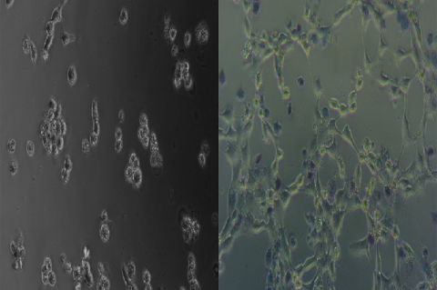 Cell photograph after 6 hr of incubation. Left: internal control with no treatment, Right: treated with 50 μg/mL of CPH ethanolic extract.