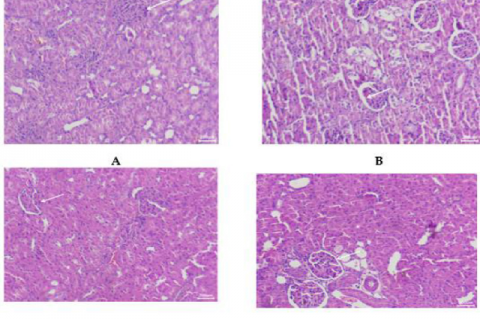 Histopathological variations of kidneys under the effect of Ecklonia cava polyphenols alongside KBrO3.