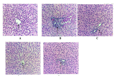 Effect of Calx of Copper against antitubercular drugs (INH, RIF, and PYZ) induced histopathological alteration in experimental groups of rats (H&E staining @ 40X). (A) Normal control, (B) positive control anti- tubercular drugs (INH, RIF, and PYZ) induced rat liver damage, (C and D) Histological Examination of Hepatic Tissue in Rats Administered with Copper Calx at Doses of 6.17 mg/kg and 12.33 mg/kg, (E) Histological Analysis of Hepatic Tissue in Silymarin-Treated Rats.