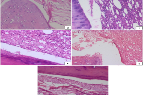 Pictogram of the knee joint of (A) normal control; (B) arthritic control; (C) diclofenac treated; (D and E) RD/M.ph.AA-01 treated at the dose of 270 mg/kg and 405 mg/kg body weight respectively. (H & E × 100)