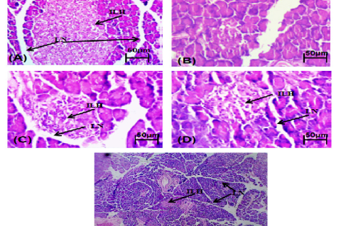 Effect of Insuwin and Insuwin forte on pancreas histopathological changes in diabetic rats. Effect of Insuwin and Insuwin forte on pancreas