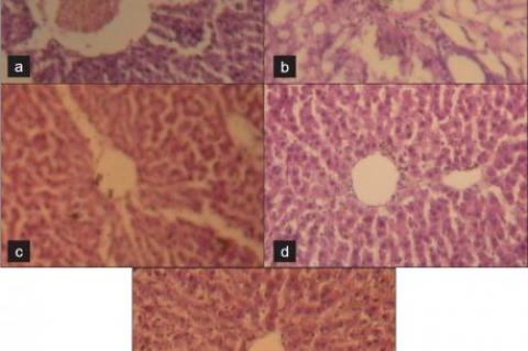 Hepatoprotective activity of Ocimum sanctum alcoholic leaf extract against paracetamol-induced liver damage in Albino rats