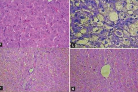 Evaluation of acute toxicity and hepatoprotective activity of the methanolic extract of Dichrostachys cinerea (Wight and Arn.) leaves