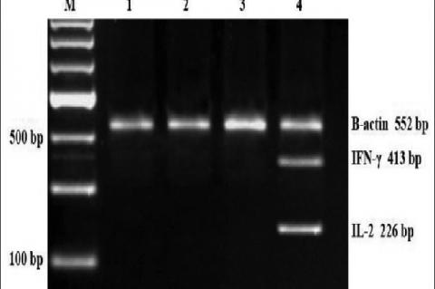 Reverse transcription‑polymerase chain reaction analysis of interleukin 2 and interferon‑γ expression in rat peripheral blood mononuclear cell treated with immunoglobulin Y anti‑Mycobacterium tuberculosis (0, 25, 50, and 100 μg/mL) for 72 h. Representative result is shown on 2% agarose gel electrophoresis displaying mRNA transcripts of interleukin 2, interferon‑γ, and β‑actin. Lane 1 = control (0 μg/mL immunoglobulin Y anti‑Mycobacterium tuberculosis); lane 2, 3, and 4 = Immunoglobulin Y anti M. tuberculosi