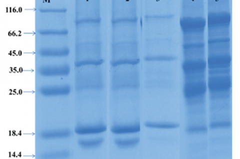 Sodium dodecyl sulfate‑polyacrylamide gel electrophoresis protein banding patterns of Memecylon species M: Marker