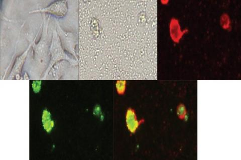 Photomicrograph of MDA-MB-231 cell lines stained with annexin-V substrate after 6 h treatment with 20 μg/mL of ethylacetate extract from G. asiatica roots