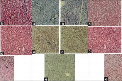 Histopathology of liver tissues. Histopathological study of paracetamol-induced hepatotoxicity