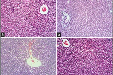 Photomicrographs of hematoxylin and eosin stained liver. Liver of control and Hypnea musciformis alone administered rats showed normal liver architecture.