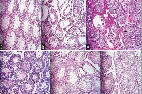 (a) The bilateral testes in sham group and the contralateral testes in date palm-treated group indicated normal seminiferous tubules
