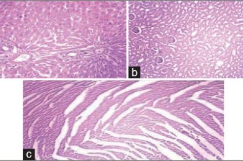 (a) The picture shows normal hepatocytes, central vein, and portal tracts (×40) (at column width); 