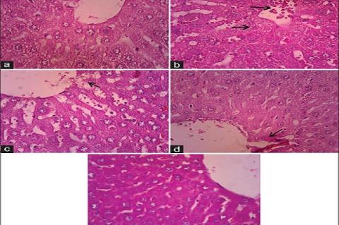 Histological study of liver tissue in control and experimental groups of rats