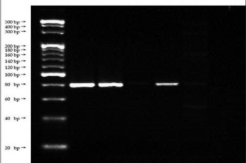 8.0% polyacrylamide gel electrophoresis polymerase chain reaction products amplified with the Equids-specific primer