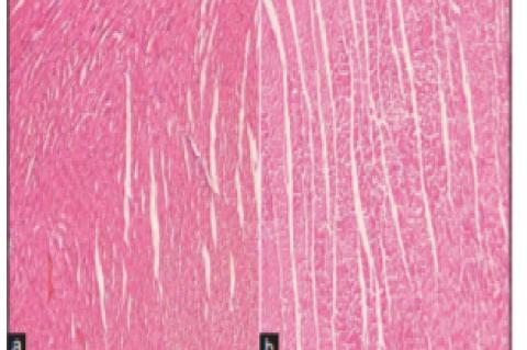 Photomicrographs of transverse sections of the heart of the control group