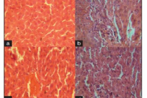 Photomicrograph of liver sections rats treated with Juglans 