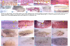 Microscopy and powder microscopy of the seeds of Senna uniflora (Mill.) H. S. Irwin and Barneby.& B. Microscopy and powder microscopy of the seeds of Senna tora (L.) Roxb.