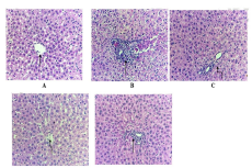 Effect of Calx of Copper against antitubercular drugs (INH, RIF, and PYZ) induced histopathological alteration in experimental groups of rats (H&E staining @ 40X). (A) Normal control, (B) positive control anti- tubercular drugs (INH, RIF, and PYZ) induced rat liver damage, (C and D) Histological Examination of Hepatic Tissue in Rats Administered with Copper Calx at Doses of 6.17 mg/kg and 12.33 mg/kg, (E) Histological Analysis of Hepatic Tissue in Silymarin-Treated Rats.
