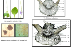 Stachytarpheta indica (L.) Vahl., TS of S. indica leaf petiole, TS of S. indica leaf and Spherocrystals of scutellarin in HCl treated leaf.